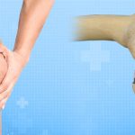 Why You Need Singapore Joint Replacement Surgery?